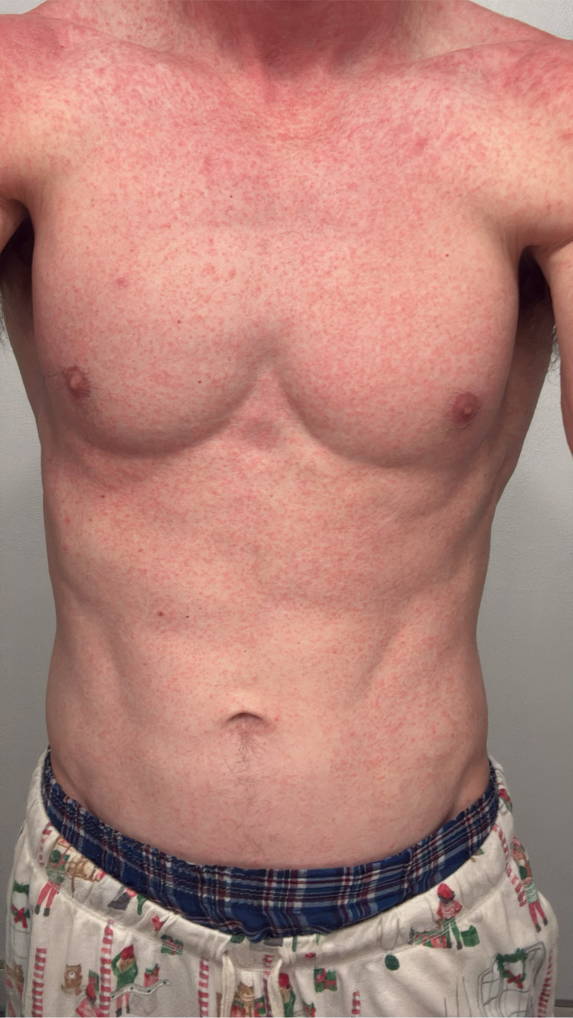 Pasted image 20260219153642.png