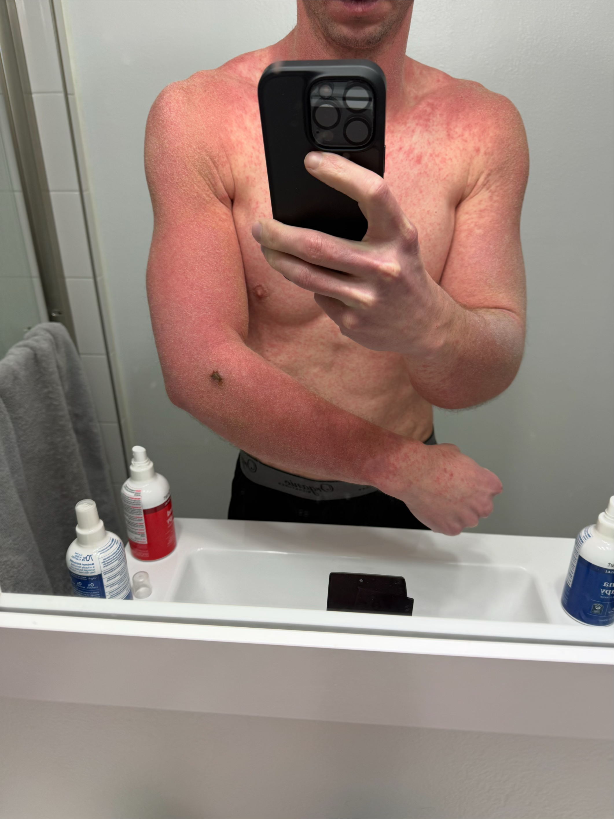 Pasted image 20260219154328.png